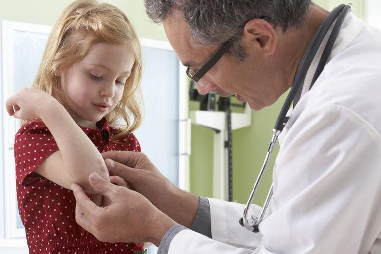 doctor examining a child with psoriasis