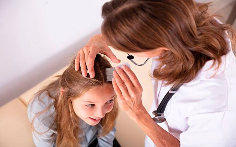 treatment of head psoriasis in children